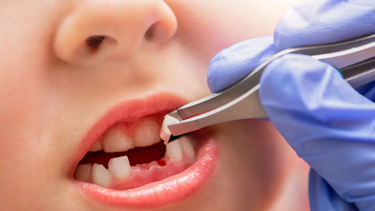 A Complete Guide to Children’s Teething