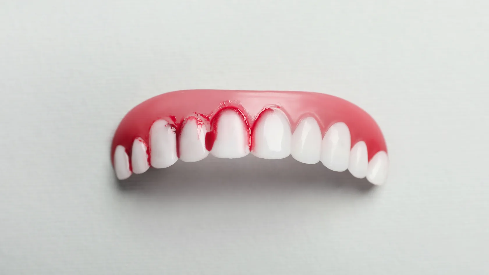 Gingivitis Adalah Radang Gusi: Kenali Gejala Awal dan Cara Mencegahnya