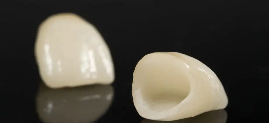 Pasang Crown Gigi: Panduan Memilih Dental Crown untuk Gigi Patah dan Senyum Natural